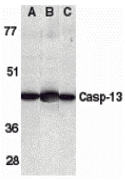 Western blot analysis of caspase-13 in human HL60 cell lysate (A), mouse brain (B) and rat brain (C) tissue lysates with caspase-13 antibody at 1 μg/mL.