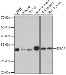 Western blot - TIRAP Rabbit mAb (A9663)