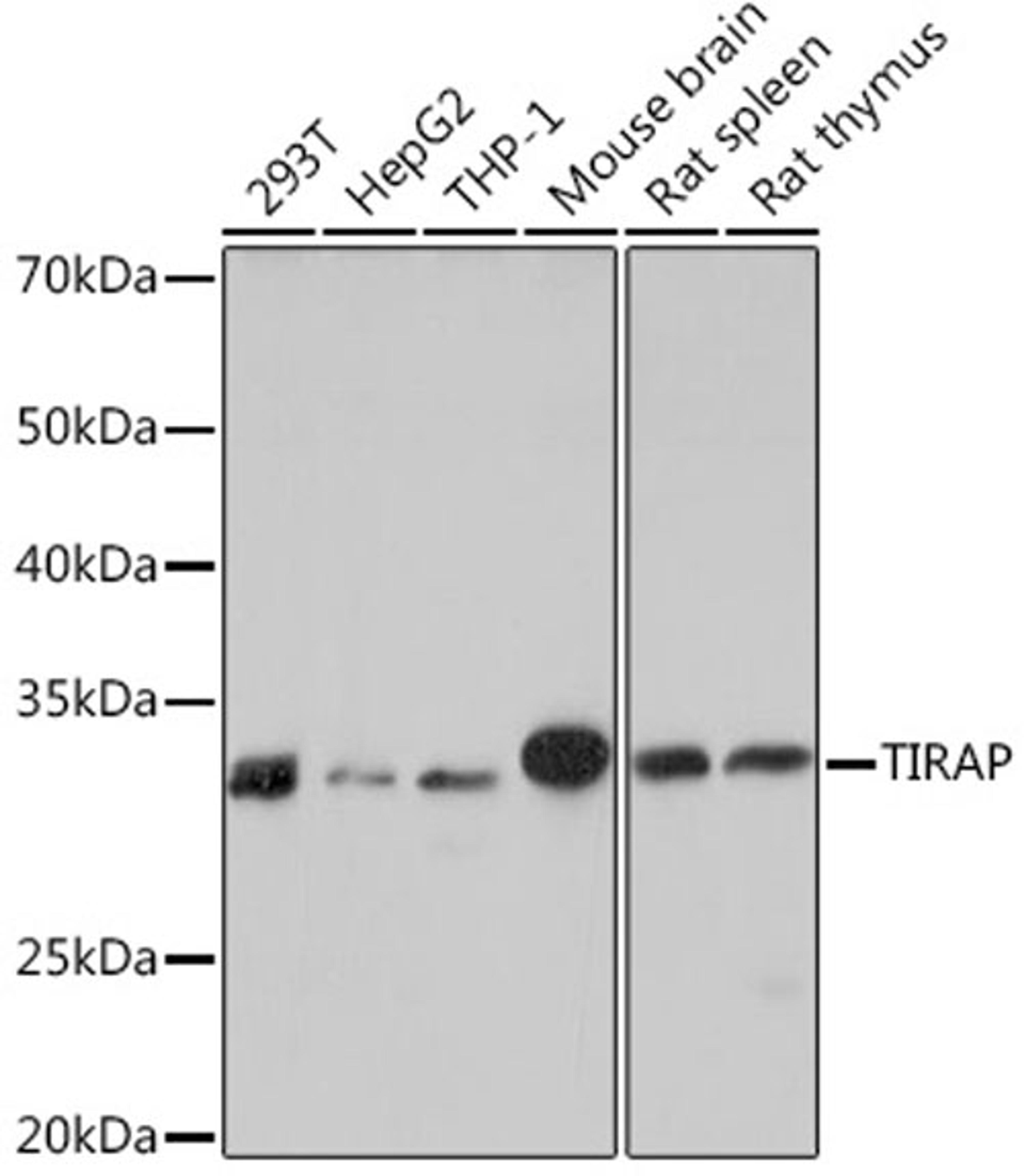 Western blot - TIRAP Rabbit mAb (A9663)