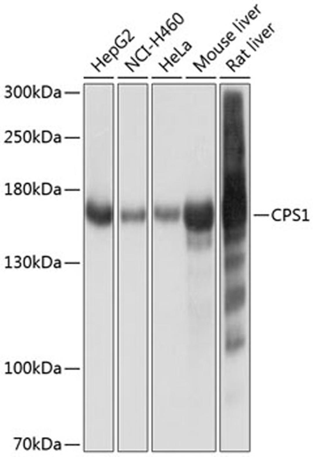 Western blot - CPS1 antibody (A8080)