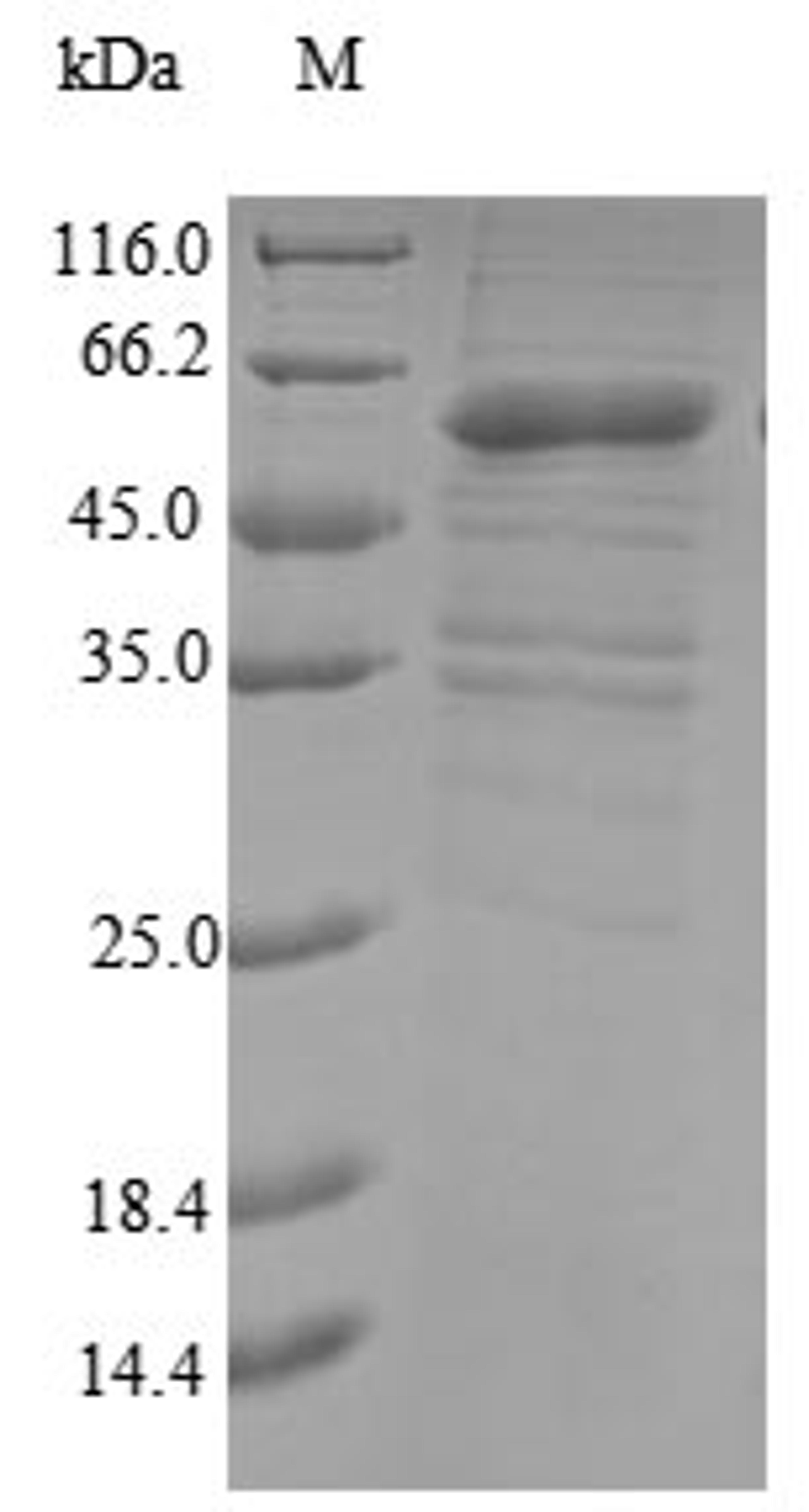 (Tris-Glycine gel) Discontinuous SDS-PAGE (reduced) with 5% enrichment gel and 15% separation gel.