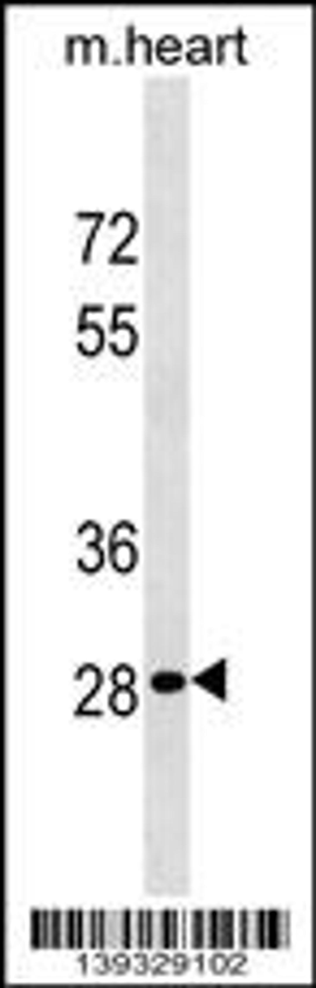 Western blot analysis in mouse heart tissue lysates (35ug/lane).