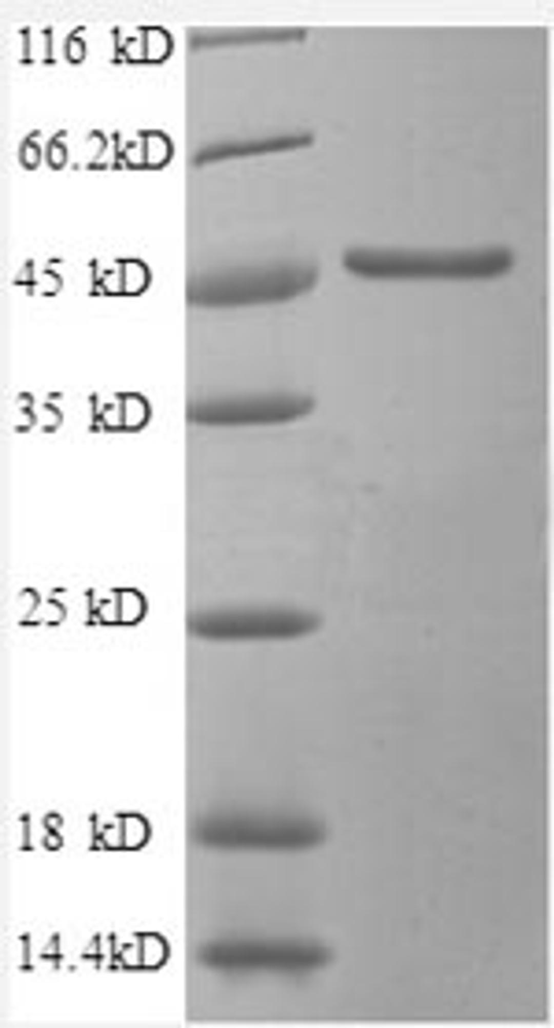 (Tris-Glycine gel) Discontinuous SDS-PAGE (reduced) with 5% enrichment gel and 15% separation gel.