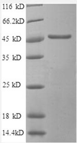 (Tris-Glycine gel) Discontinuous SDS-PAGE (reduced) with 5% enrichment gel and 15% separation gel.