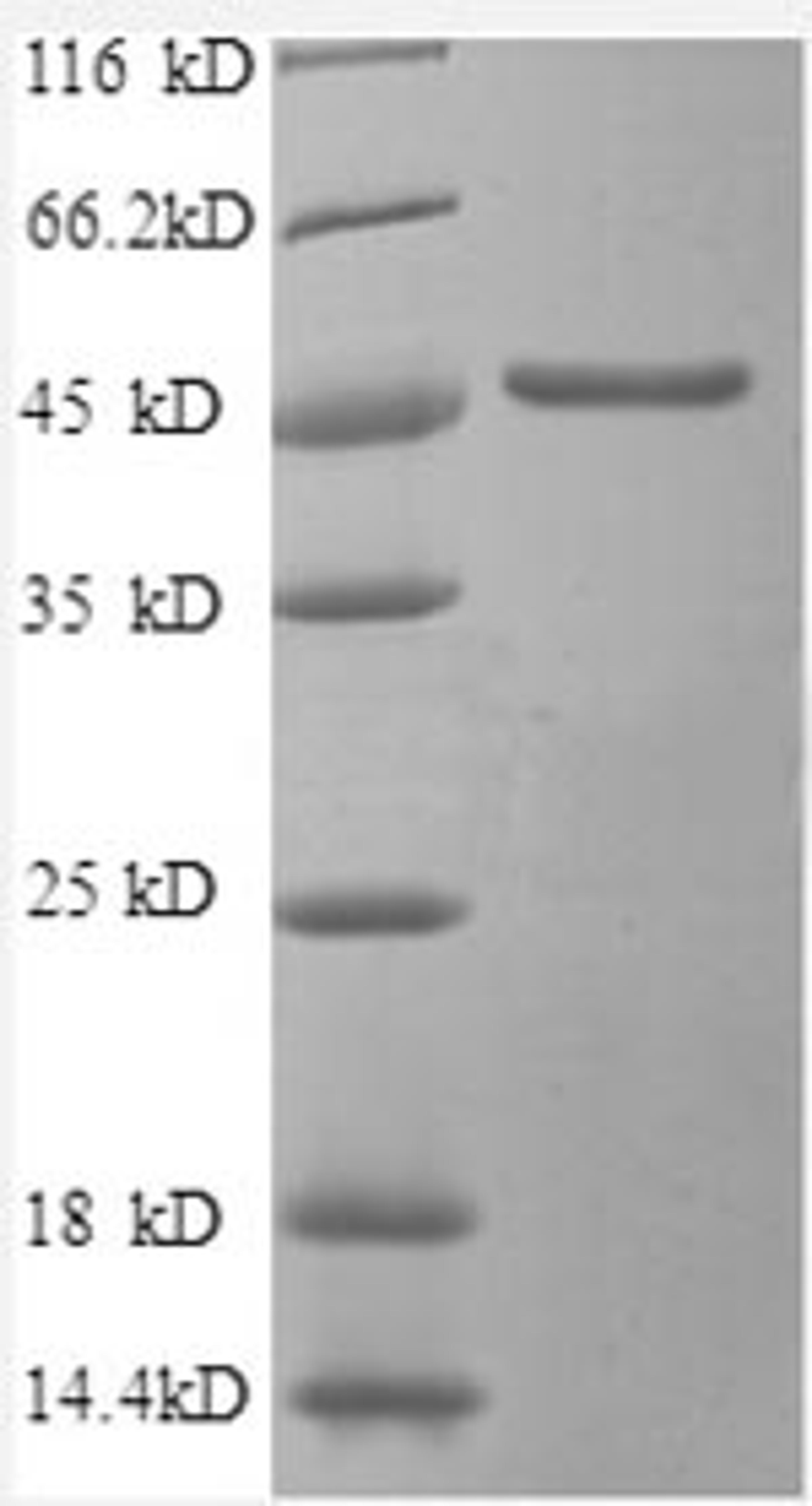 (Tris-Glycine gel) Discontinuous SDS-PAGE (reduced) with 5% enrichment gel and 15% separation gel.