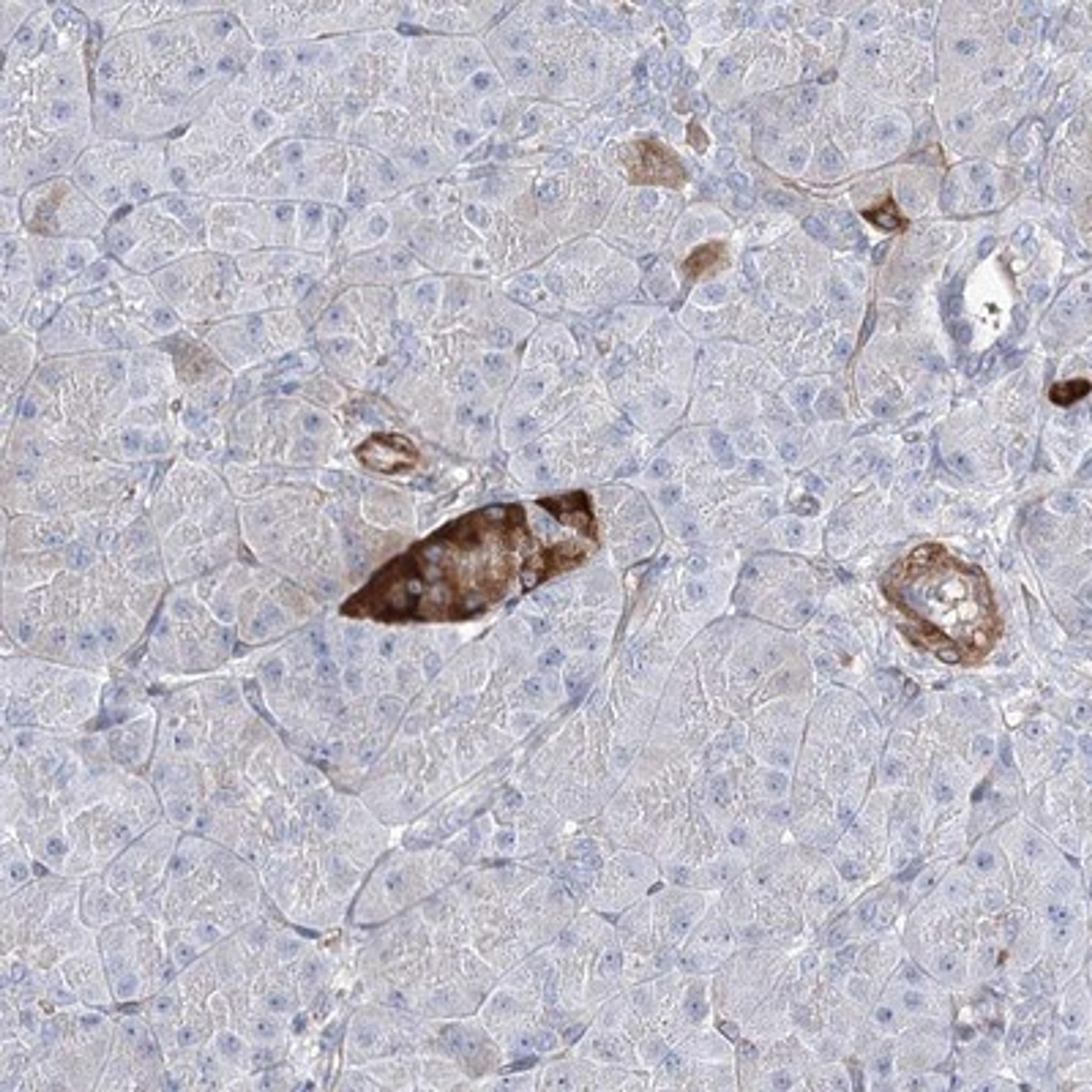 Immunohistochemistry-Paraffin: C12orf32 Antibody [NBP1-93694] - Staining of human pancreas shows strong cytoplasmic positivity in exocrine glandular cells.