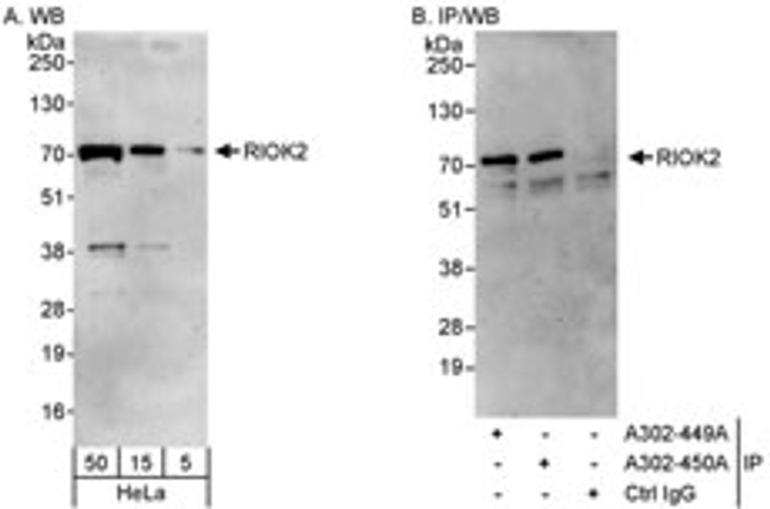 Detection of human RIOK2 by western blot and immunoprecipitation.