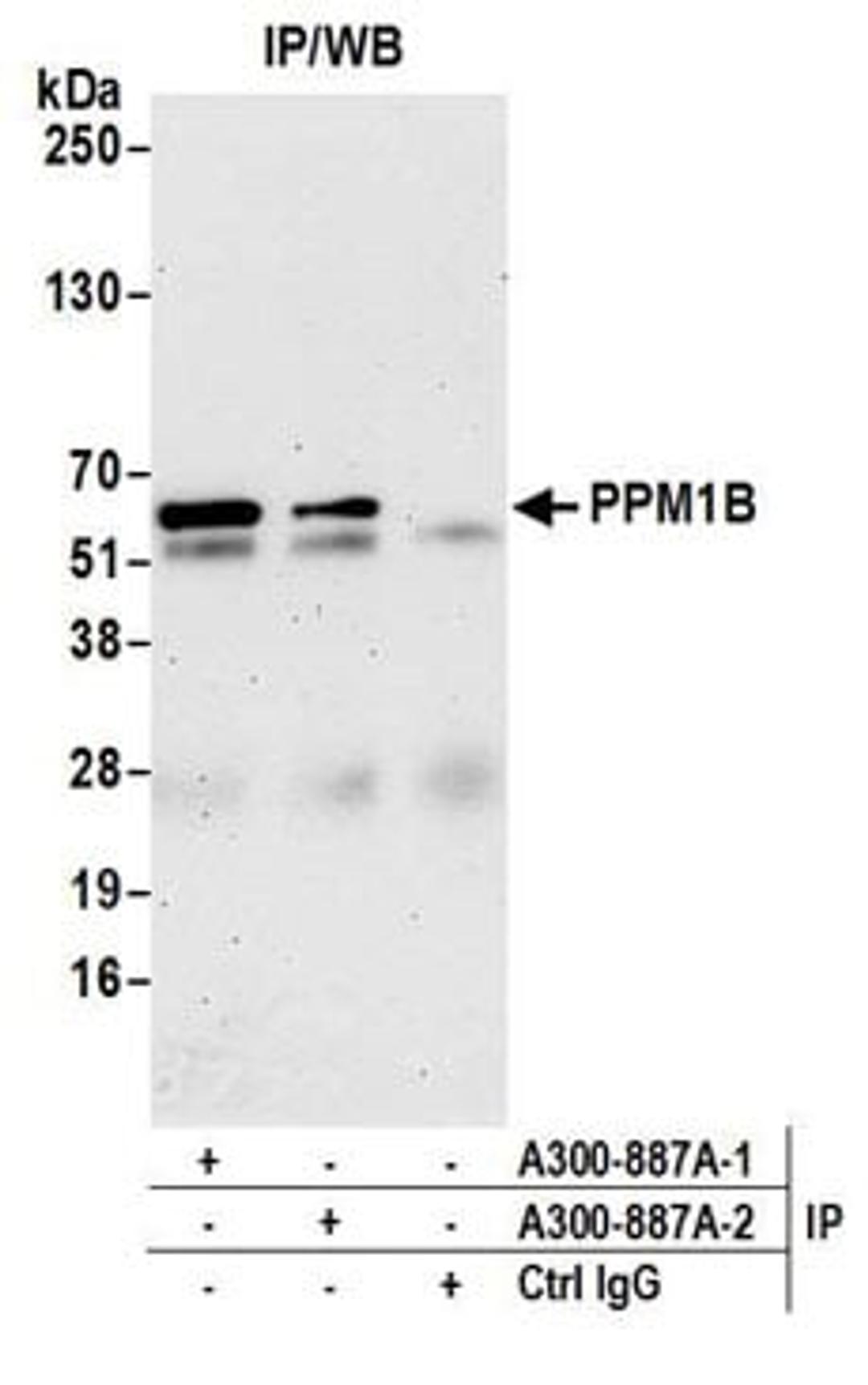 Detection of human PPM1B by western blot of immunoprecipitates.