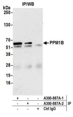 Detection of human PPM1B by western blot of immunoprecipitates.