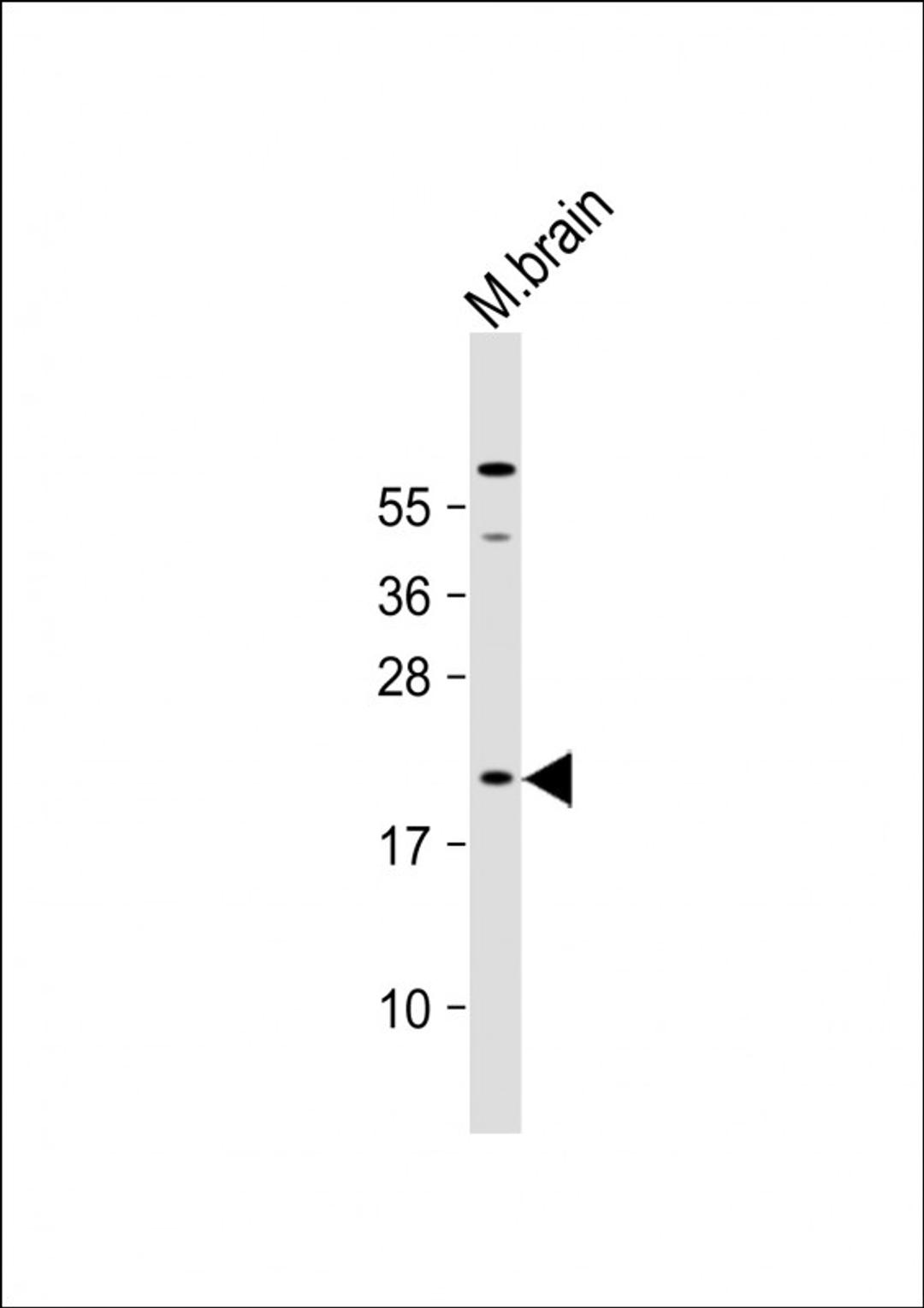 Western Blot at 1:1000 dilution + mouse brain lysate Lysates/proteins at 20 ug per lane.