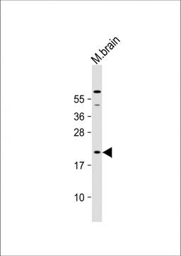 Western Blot at 1:1000 dilution + mouse brain lysate Lysates/proteins at 20 ug per lane.