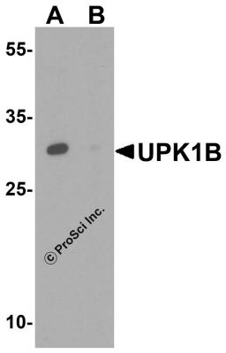 Western blot analysis of UPK1B in human kidney tissue lysate with UPK1B antibody at 1 &#956;g/mL in the (A) absence and (B) presence of blocking peptide.