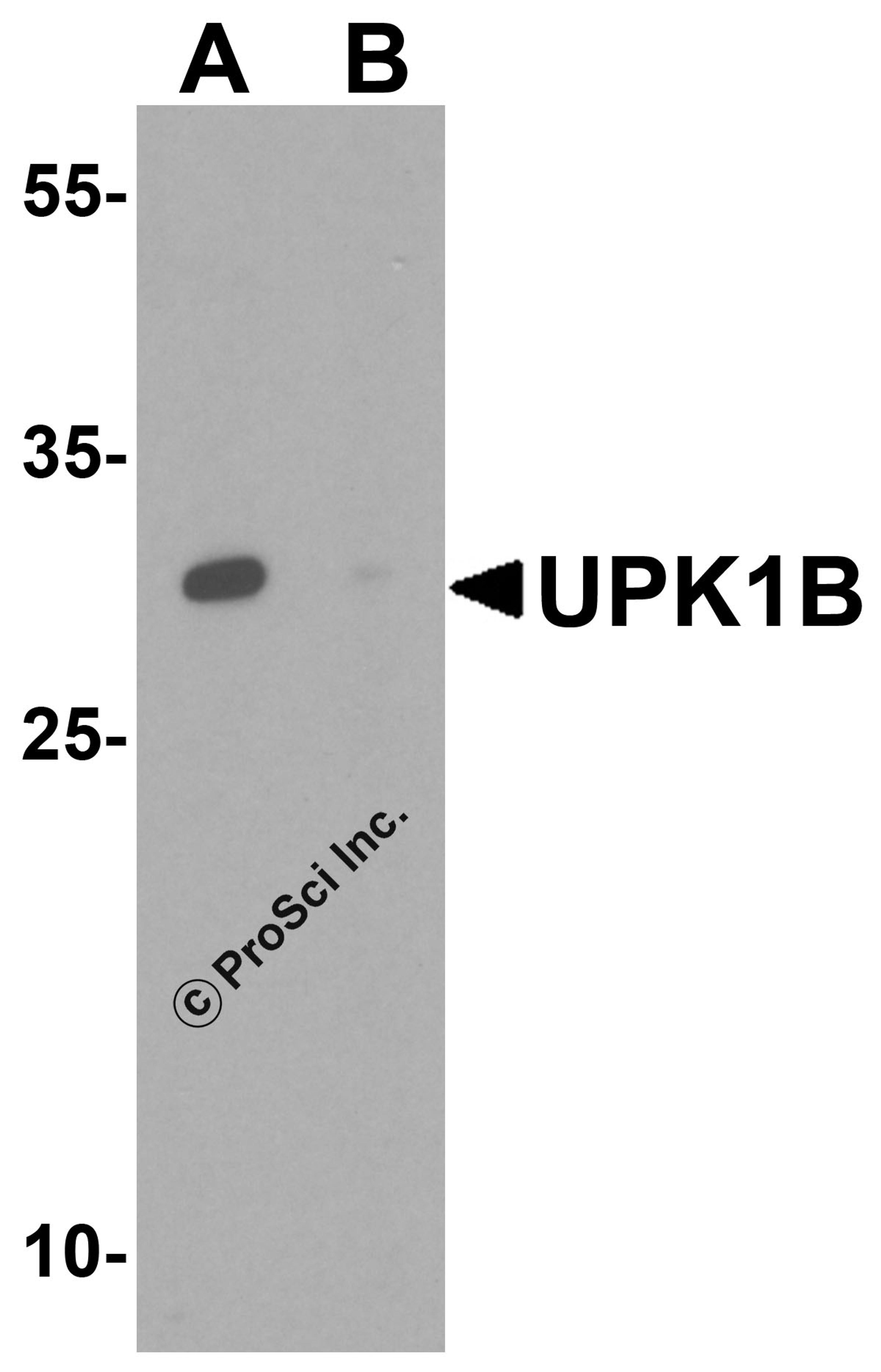 Western blot analysis of UPK1B in human kidney tissue lysate with UPK1B antibody at 1 μg/mL in the (A) absence and (B) presence of blocking peptide.