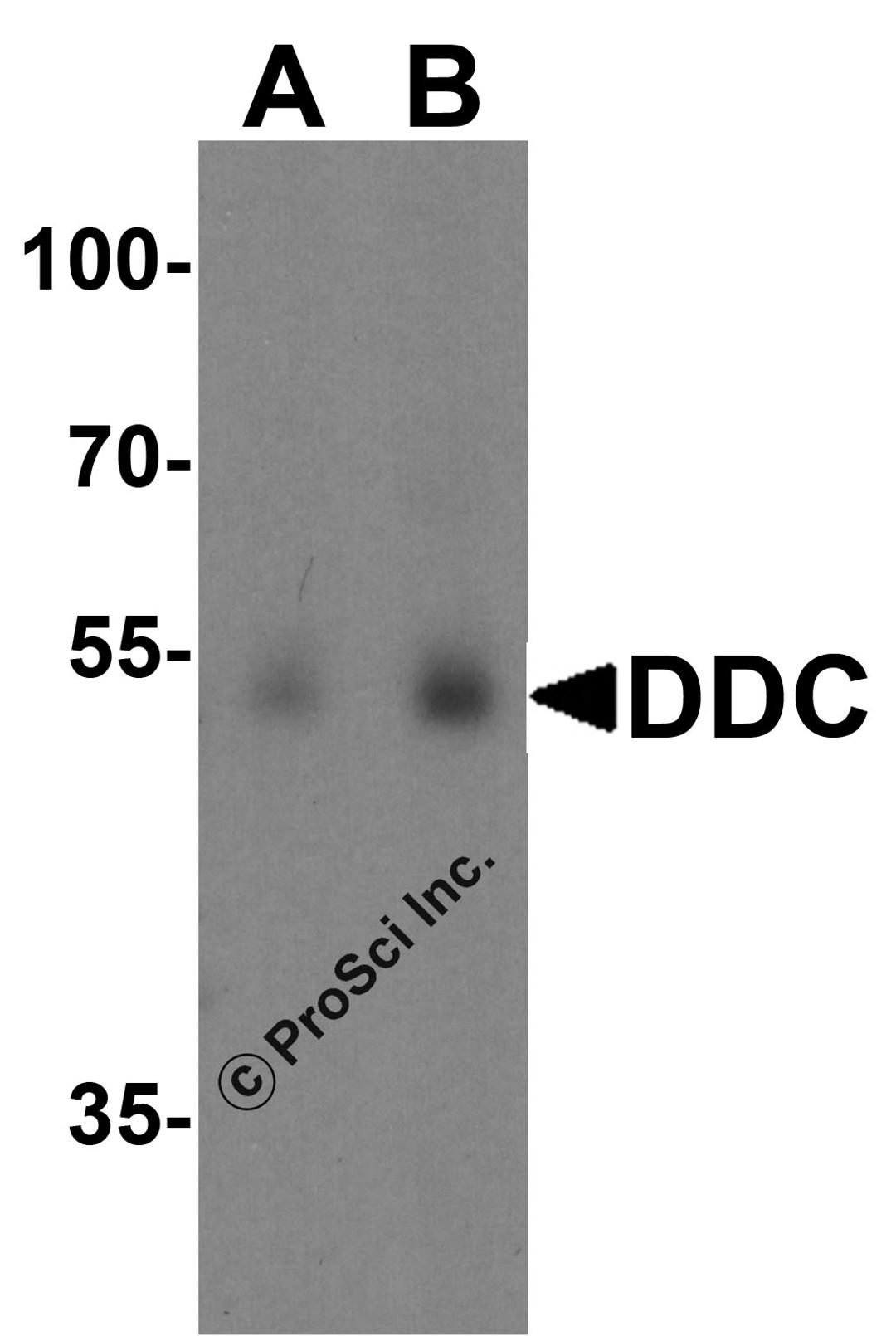 Western blot analysis of DDC in human lung tissue lysate with DDC antibody at (A) 0.5 and (B) 1 μg/ml.