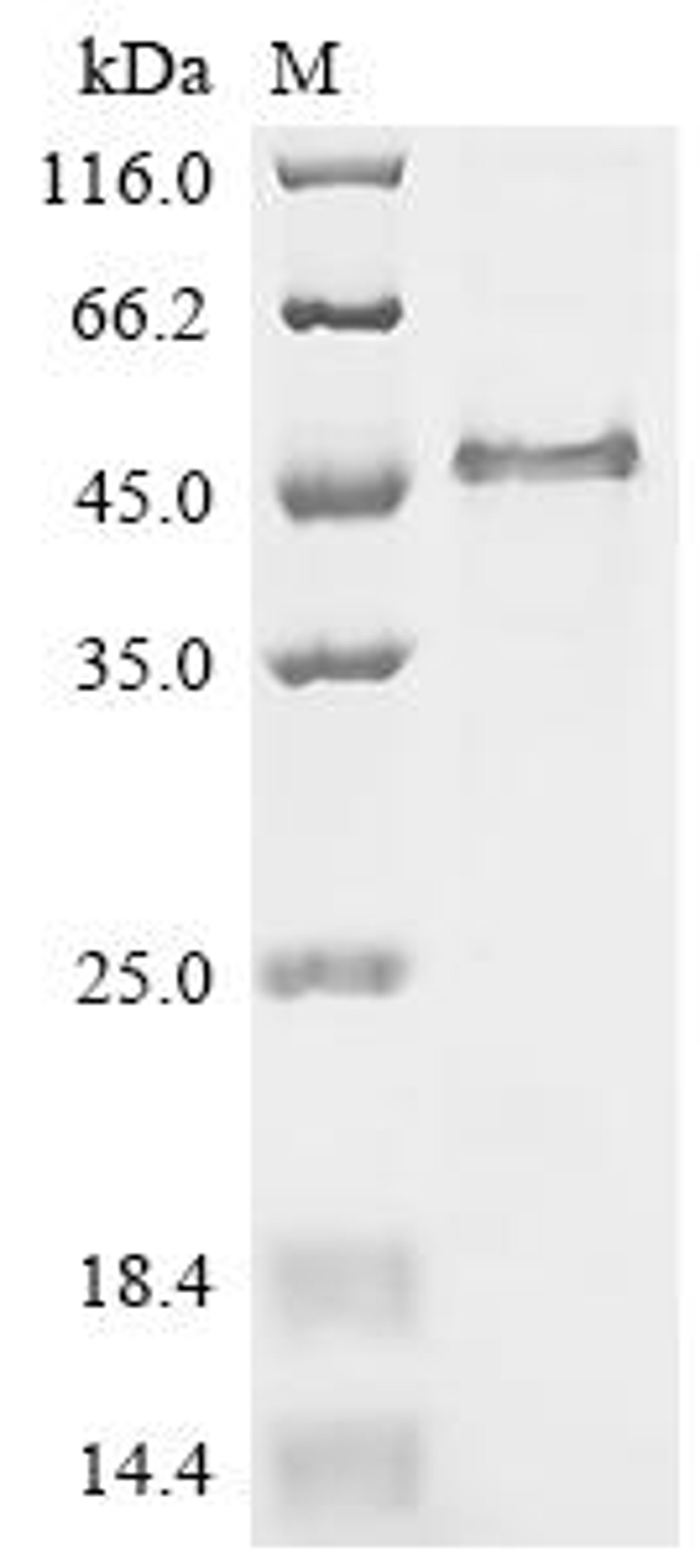 (Tris-Glycine gel) Discontinuous SDS-PAGE (reduced) with 5% enrichment gel and 15% separation gel.