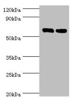 Western blot. All lanes: TROVE2 antibody at 2µg/ml. Lane 1: Hela whole cell lysate. Lane 2: 293T whole cell lysate. Secondary. Goat polyclonal to rabbit IgG at 1/10000 dilution. Predicted band size: 61, 24, 59, 60 kDa. Observed band size: 61 kDa