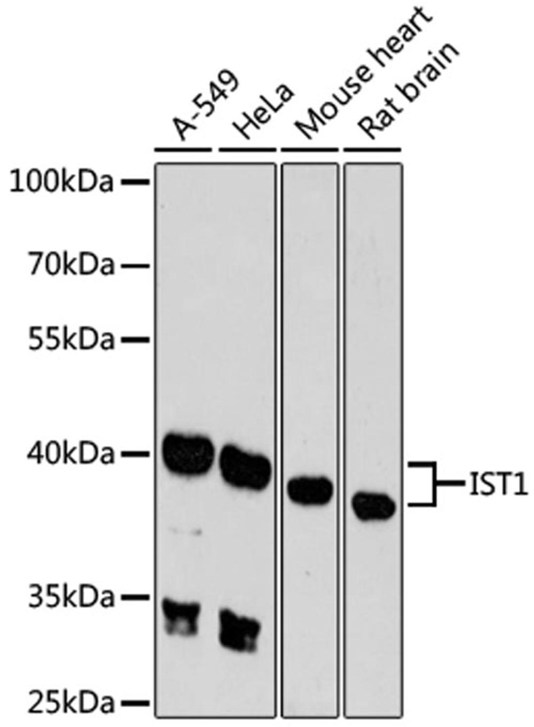 Western blot - IST1 antibody (A9401)