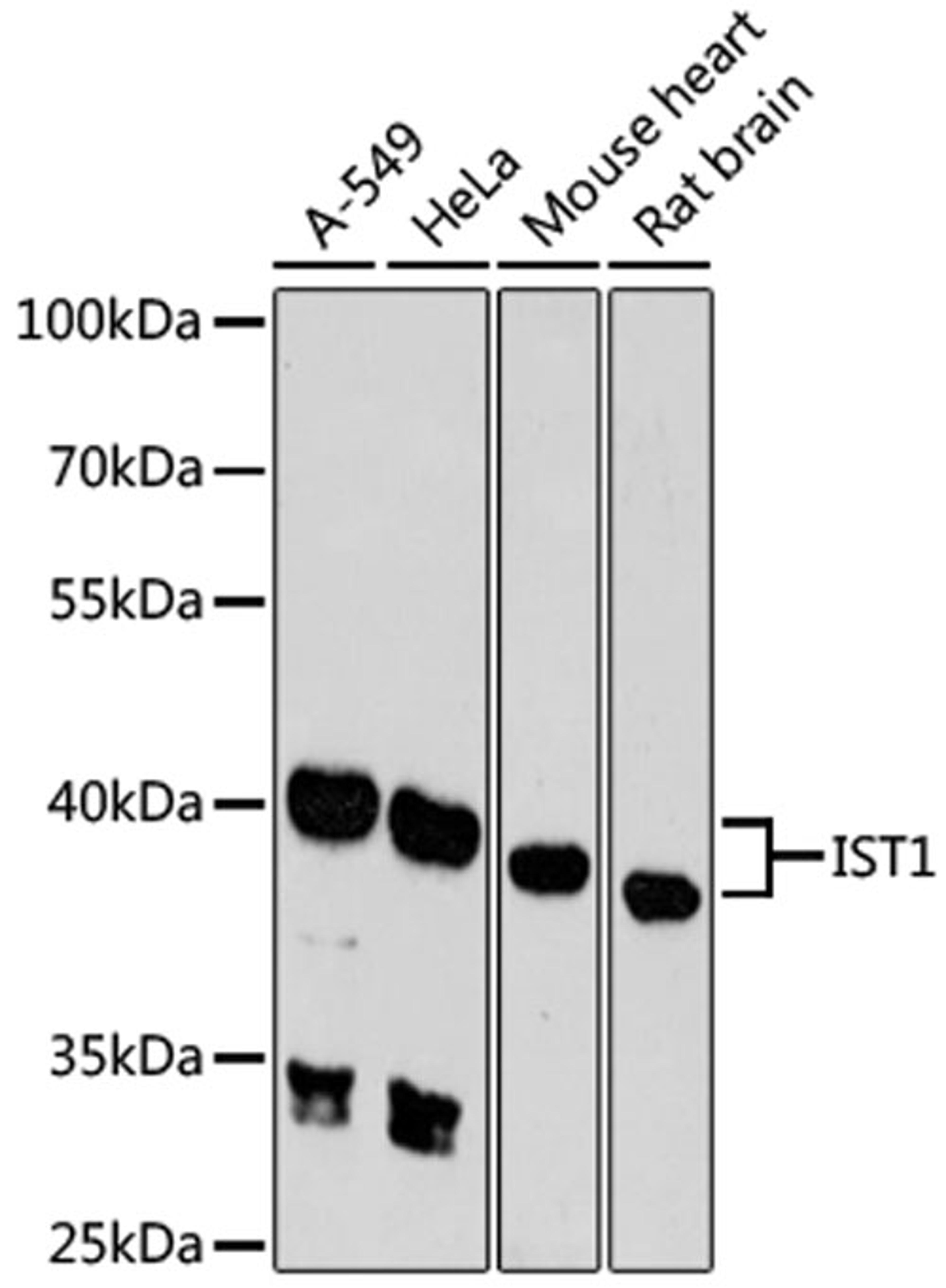 Western blot - IST1 antibody (A9401)