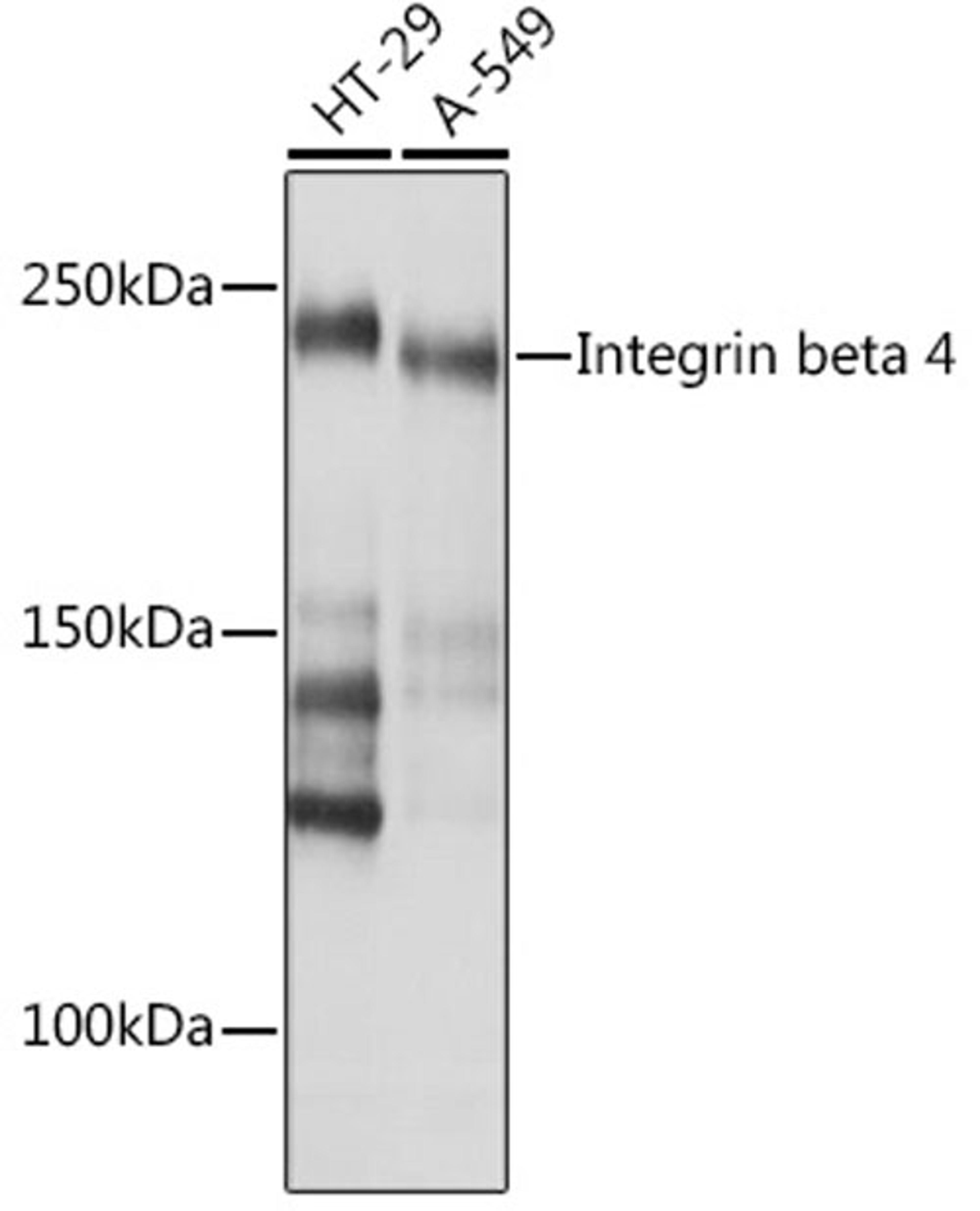 Western blot - Integrin beta 4  Rabbit mAb (A4596)