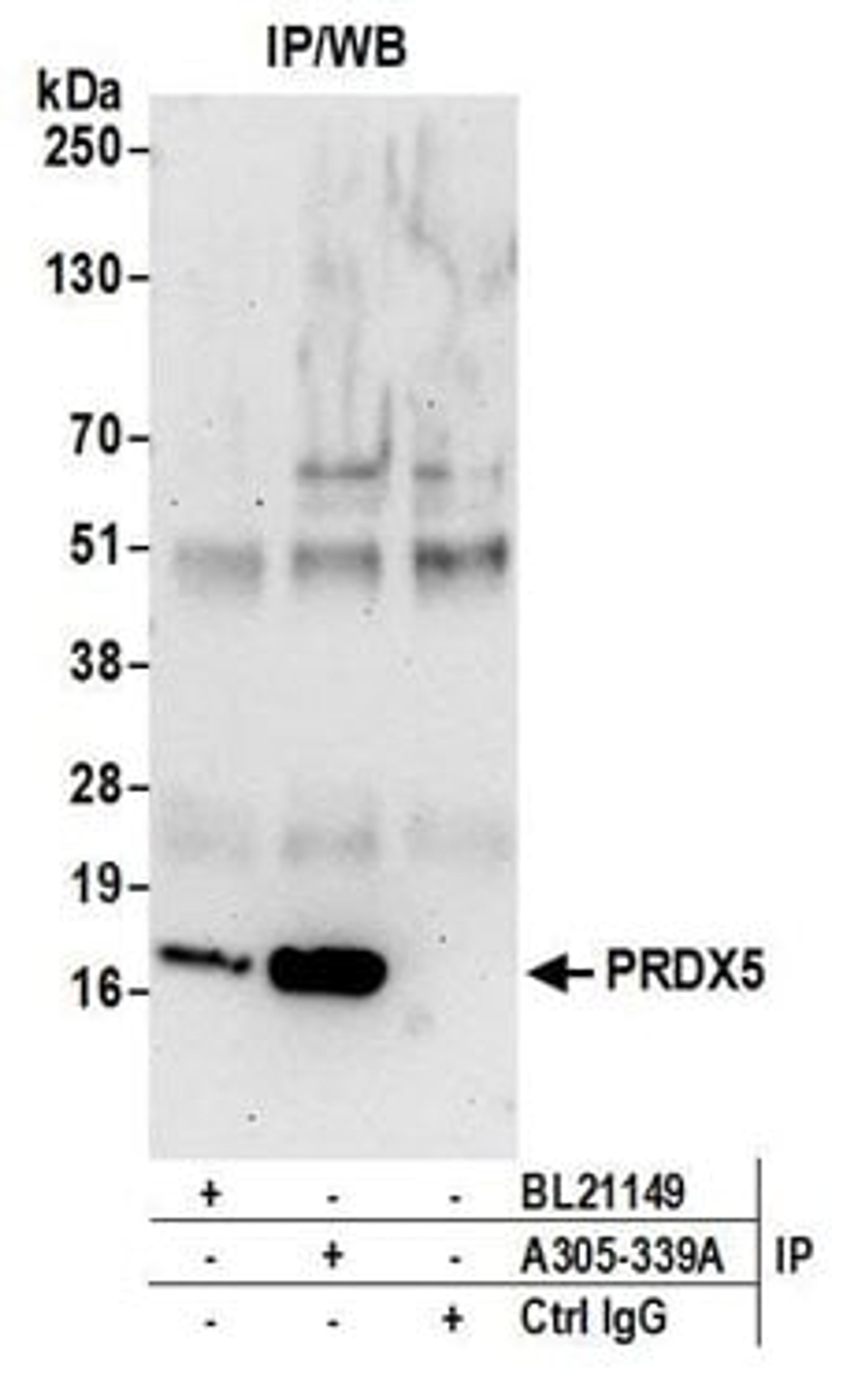 Detection of human PRDX5 by western blot of immunoprecipitates.