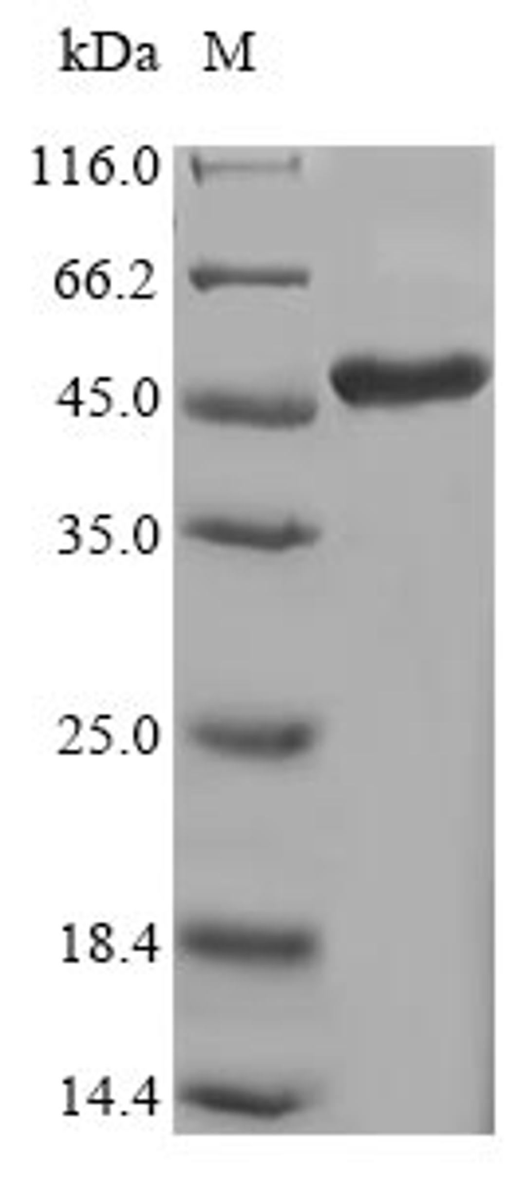 (Tris-Glycine gel) Discontinuous SDS-PAGE (reduced) with 5% enrichment gel and 15% separation gel.
