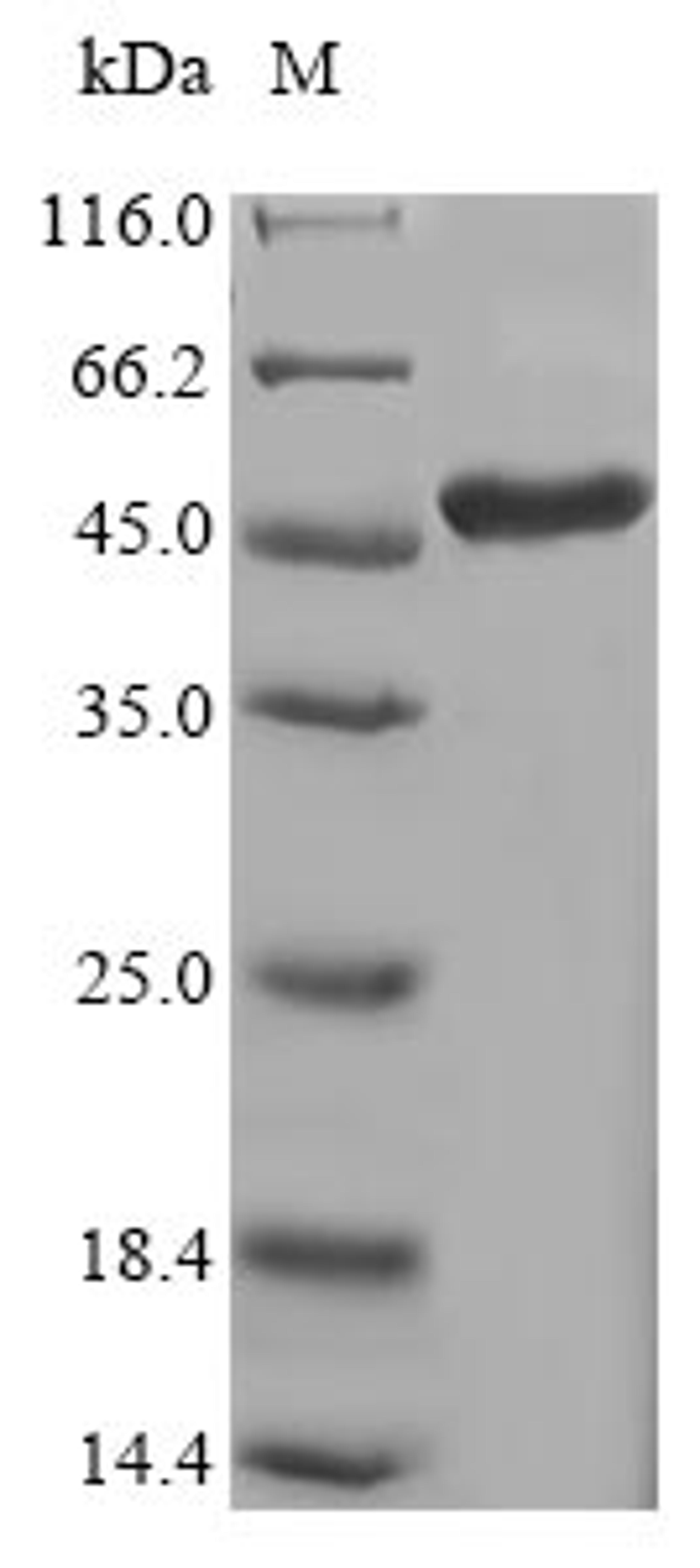 (Tris-Glycine gel) Discontinuous SDS-PAGE (reduced) with 5% enrichment gel and 15% separation gel.