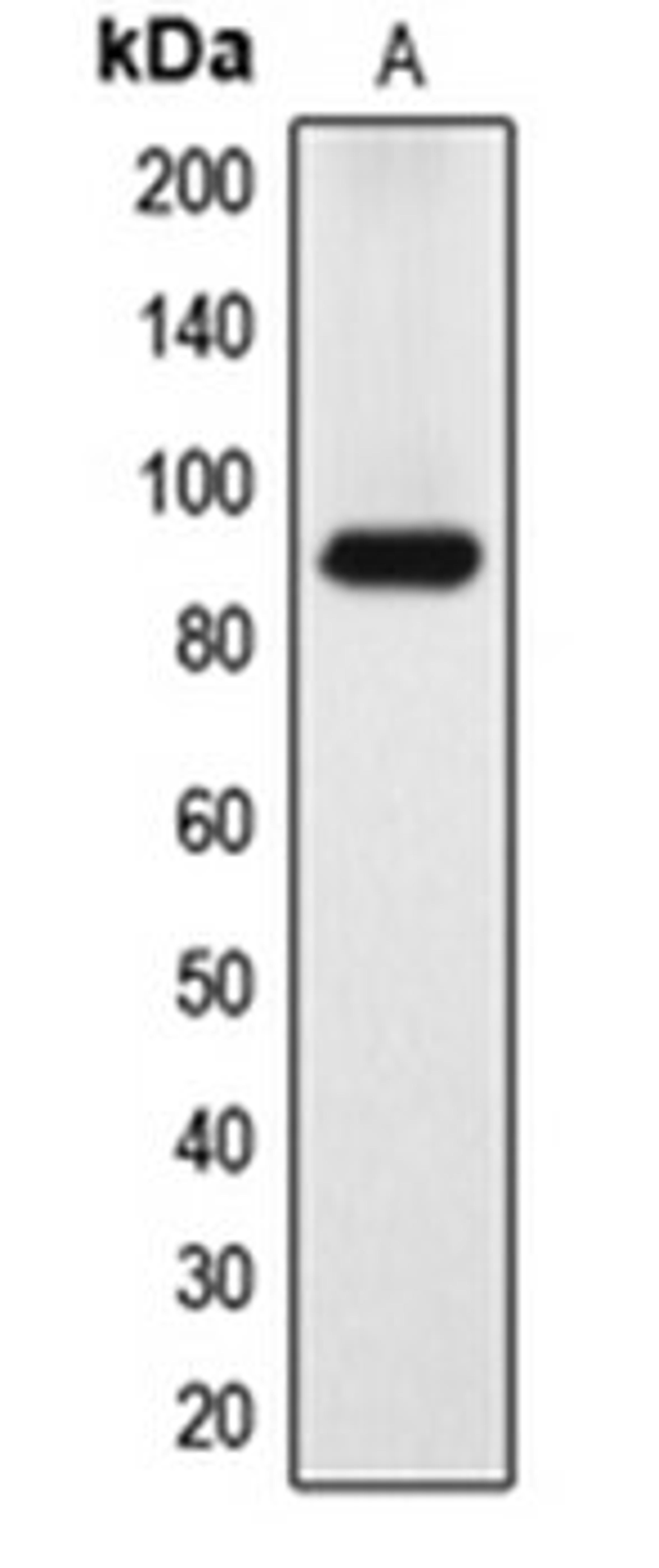 Western blot analysis of HeLa (Lane 1) whole cell lysates using DYRK1A antibody