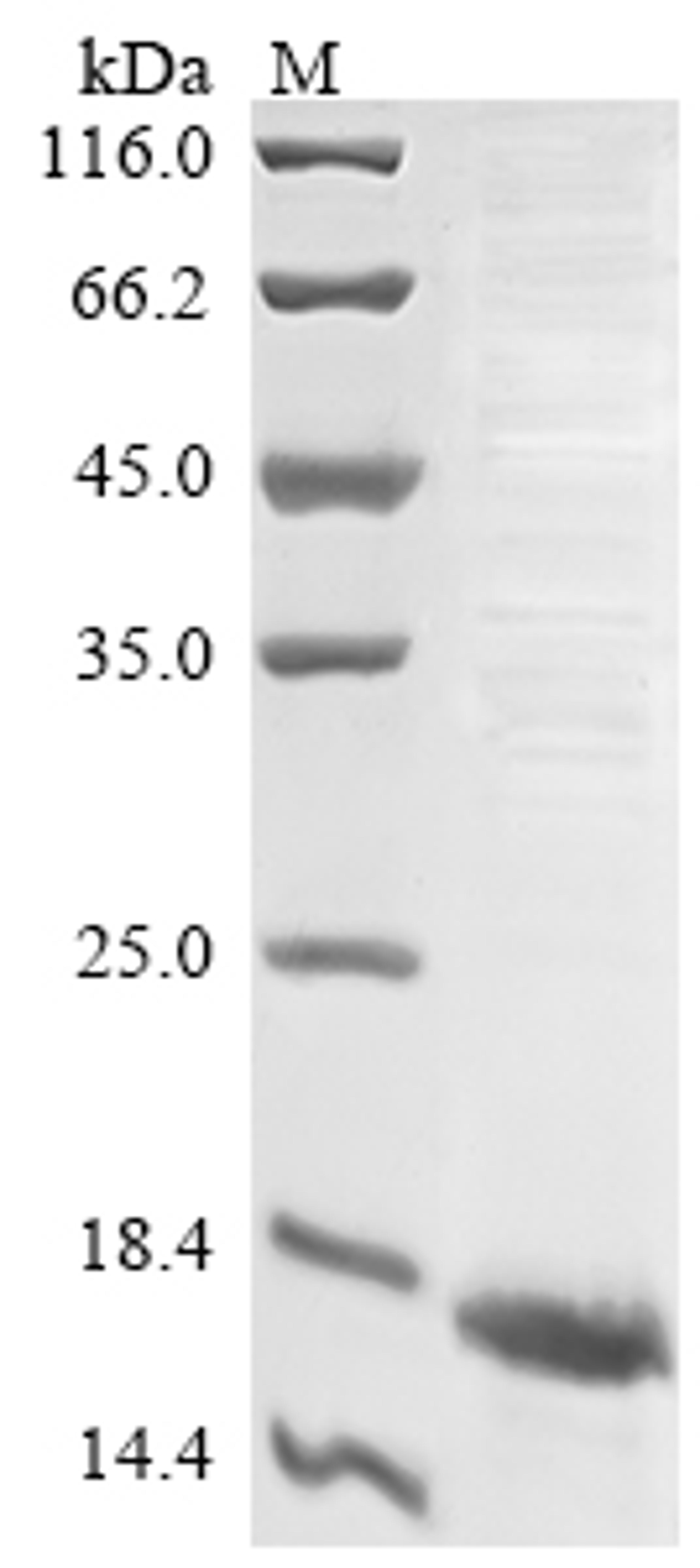 (Tris-Glycine gel) Discontinuous SDS-PAGE (reduced) with 5% enrichment gel and 15% separation gel.