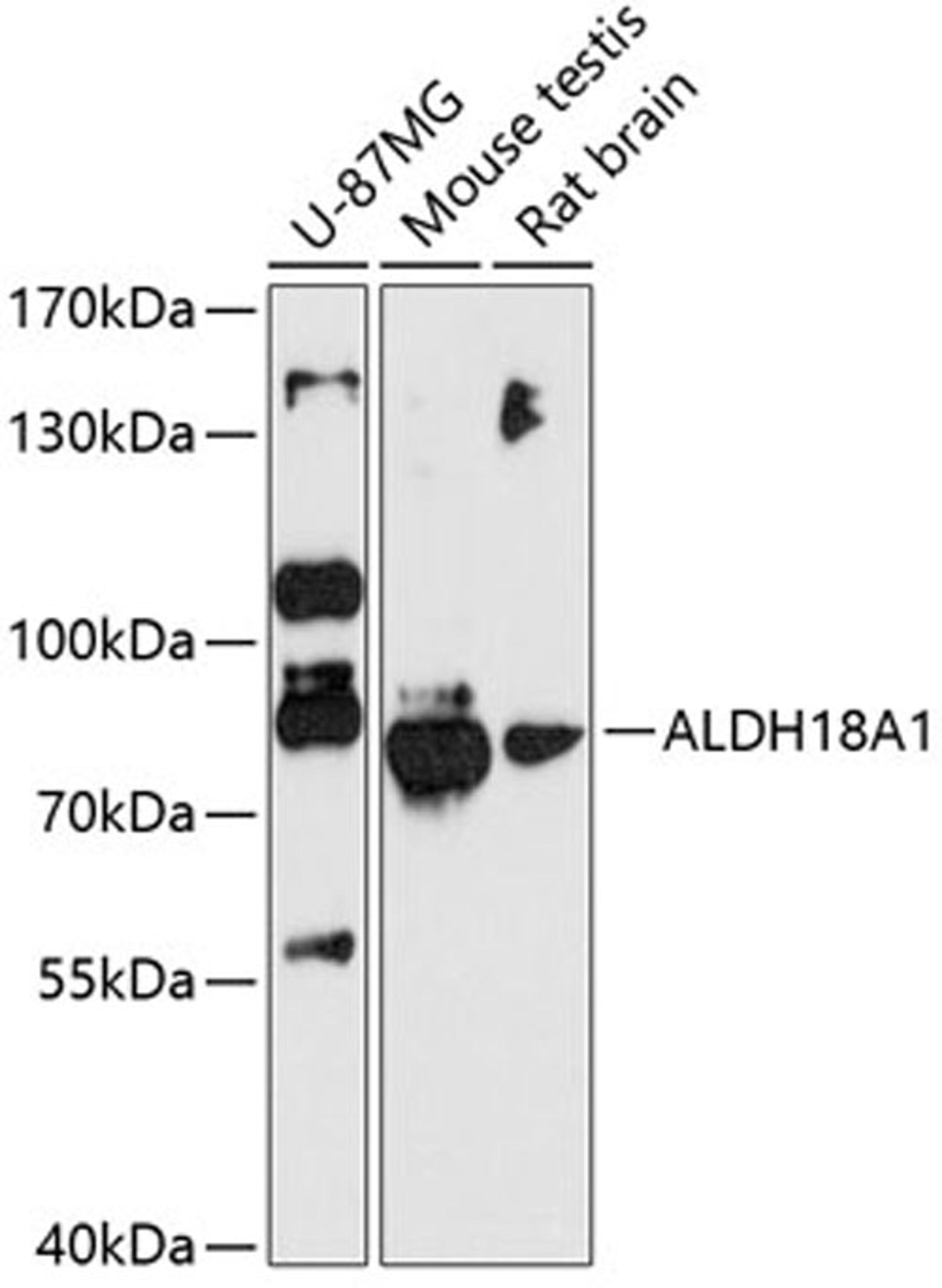 Western blot - ALDH18A1 antibody (A12247)