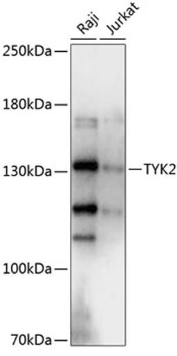 Western blot - TYK2 antibody (A2128)