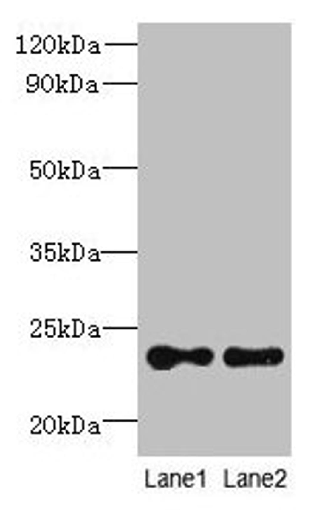 Western blot. All lanes: TMED2 antibody at 6µg/ml. Lane 1: HCT116 whole cell lysate. Lane 2: Mouse ovarian tissue. Secondary. Goat polyclonal to rabbit IgG at 1/10000 dilution. Predicted band size: 23 kDa. Observed band size: 23 kDa