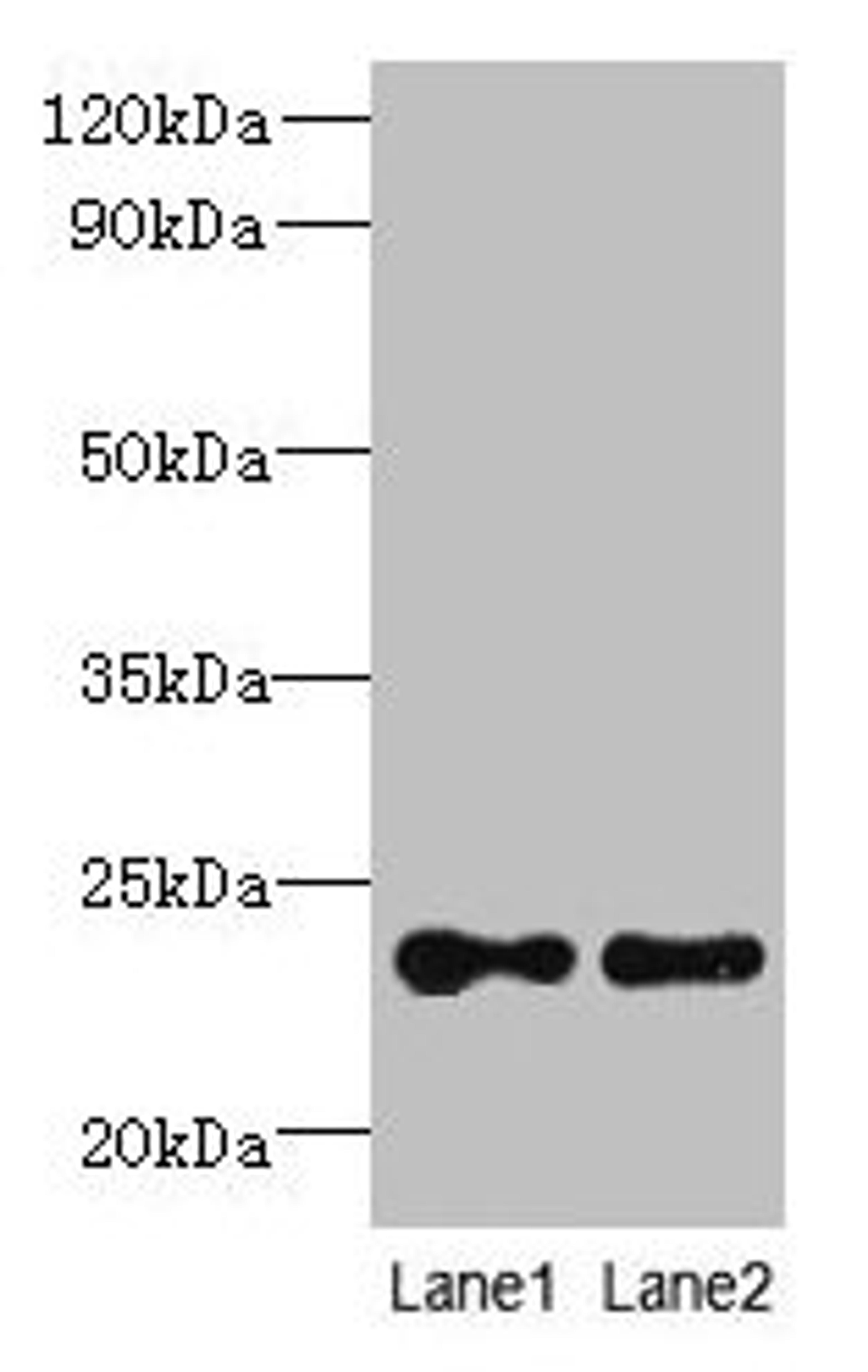 Western blot. All lanes: TMED2 antibody at 6µg/ml. Lane 1: HCT116 whole cell lysate. Lane 2: Mouse ovarian tissue. Secondary. Goat polyclonal to rabbit IgG at 1/10000 dilution. Predicted band size: 23 kDa. Observed band size: 23 kDa