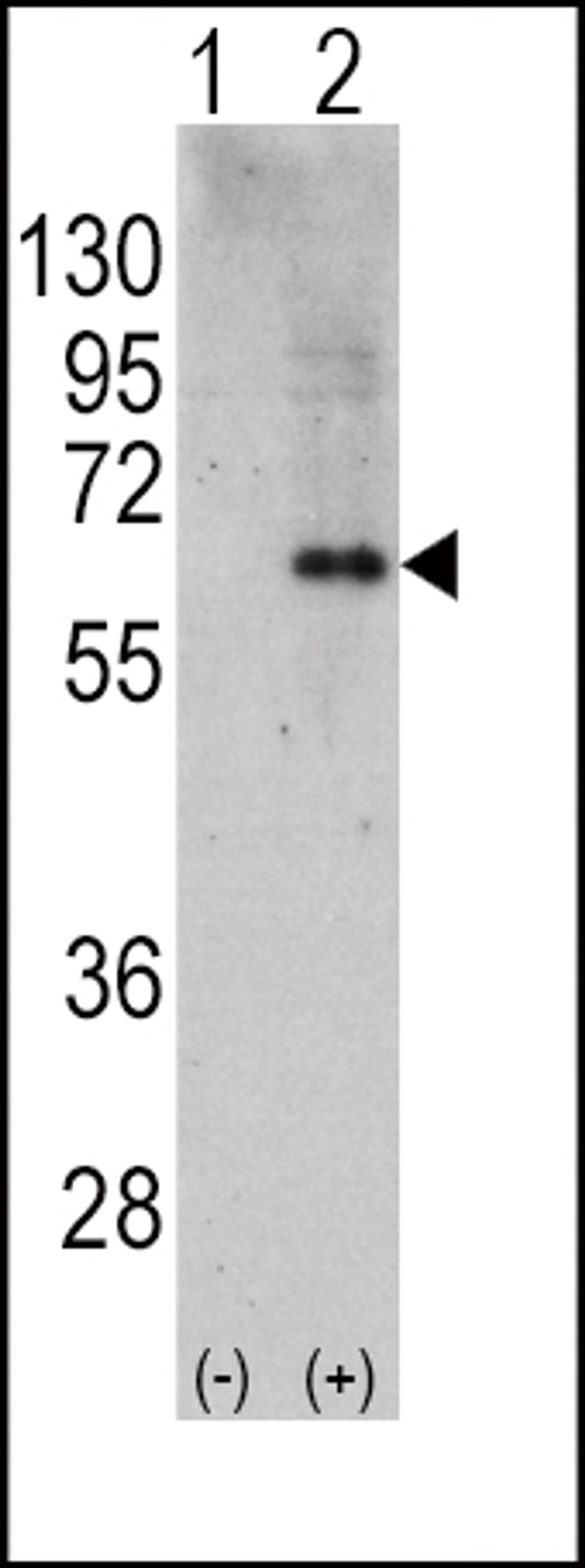 Western blot analysis of PRKAA2 using rabbit polyclonal PRKAA2 Antibody using 293 cell lysates (2 ug/lane) either nontransfected (Lane 1) or transiently transfected with the PRKAA2 gene (Lane 2).