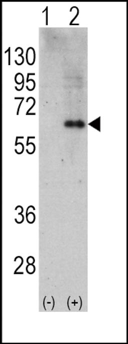 Western blot analysis of PRKAA2 using rabbit polyclonal PRKAA2 Antibody using 293 cell lysates (2 ug/lane) either nontransfected (Lane 1) or transiently transfected with the PRKAA2 gene (Lane 2).