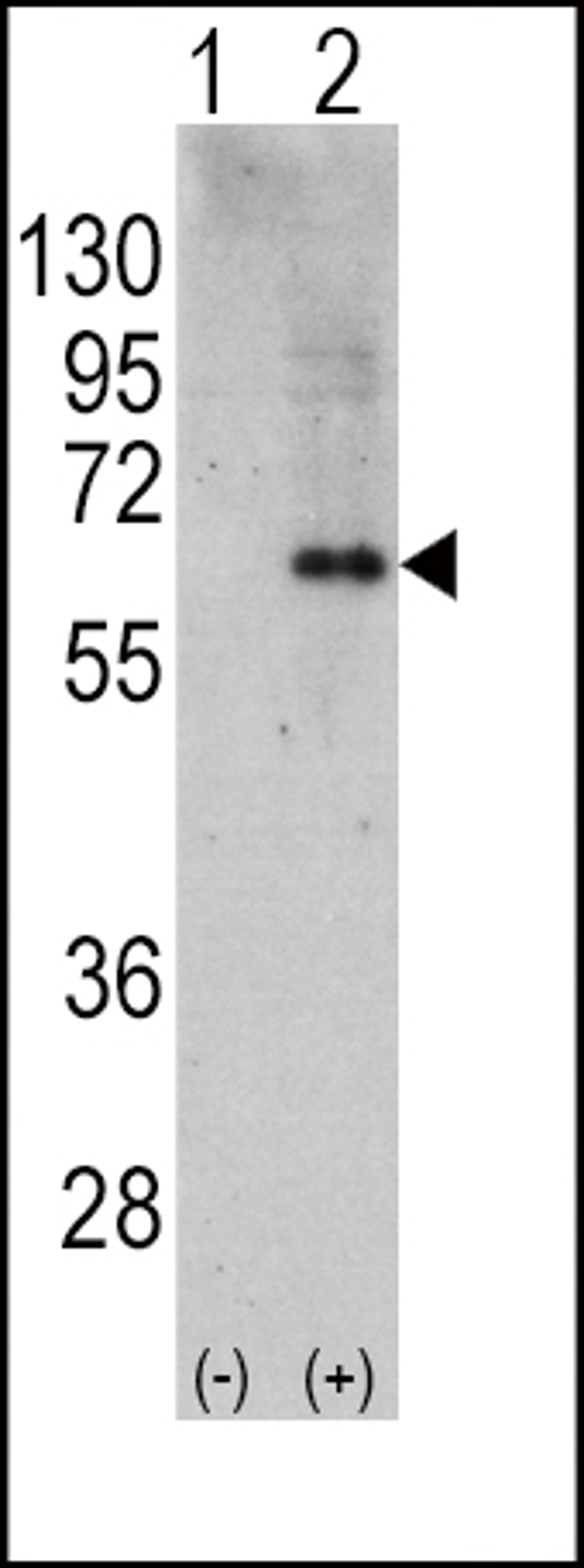 Western blot analysis of PRKAA2 using rabbit polyclonal PRKAA2 Antibody using 293 cell lysates (2 ug/lane) either nontransfected (Lane 1) or transiently transfected with the PRKAA2 gene (Lane 2).