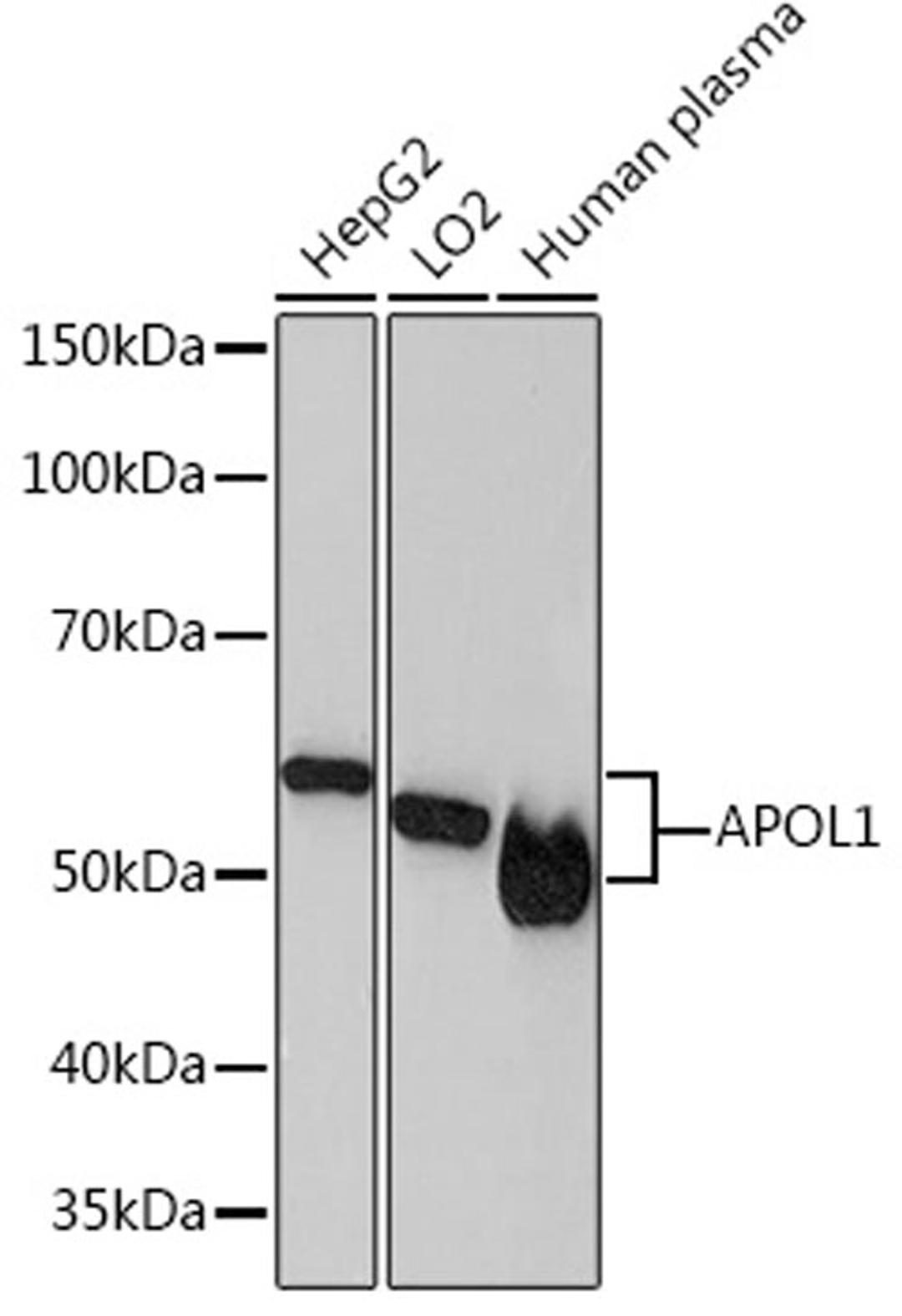 Western blot - APOL1 Rabbit mAb (A4412)