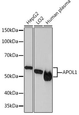 Western blot - APOL1 Rabbit mAb (A4412)