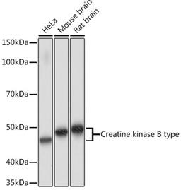 Western blot - Creatine kinase B type Rabbit mAb (A4907)