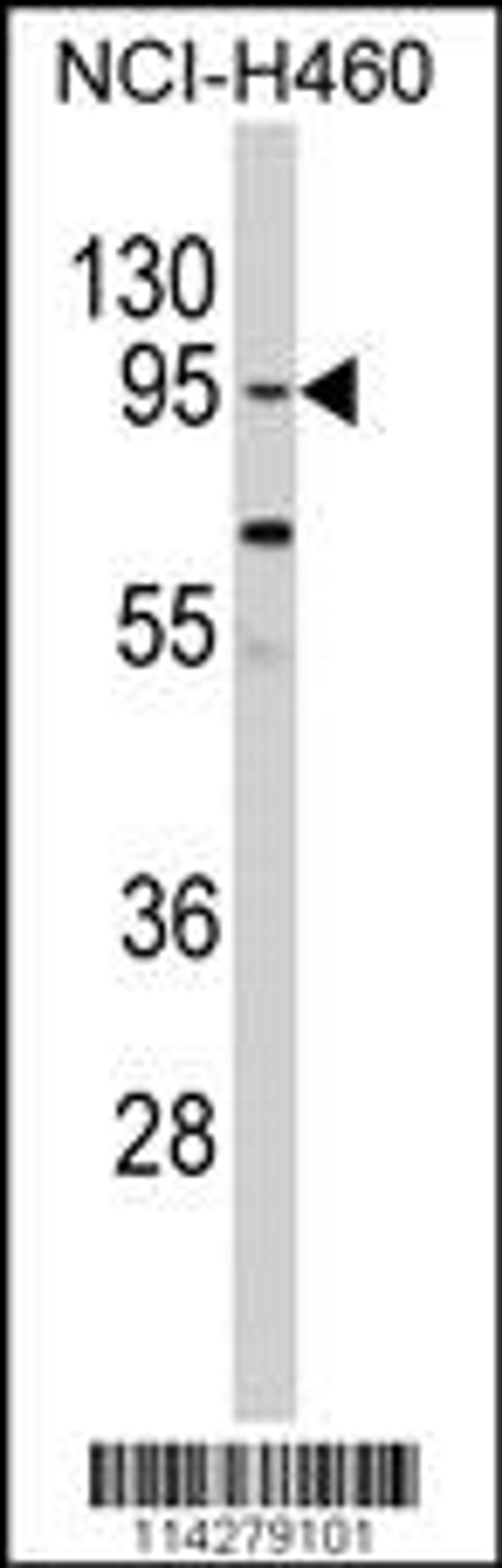 Western blot analysis of CLOCK Antibody in NCI-H460 cell line lysates (35ug/lane)