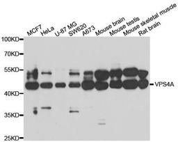 Western blot analysis of extracts of various cell lines using VPS4A antibody