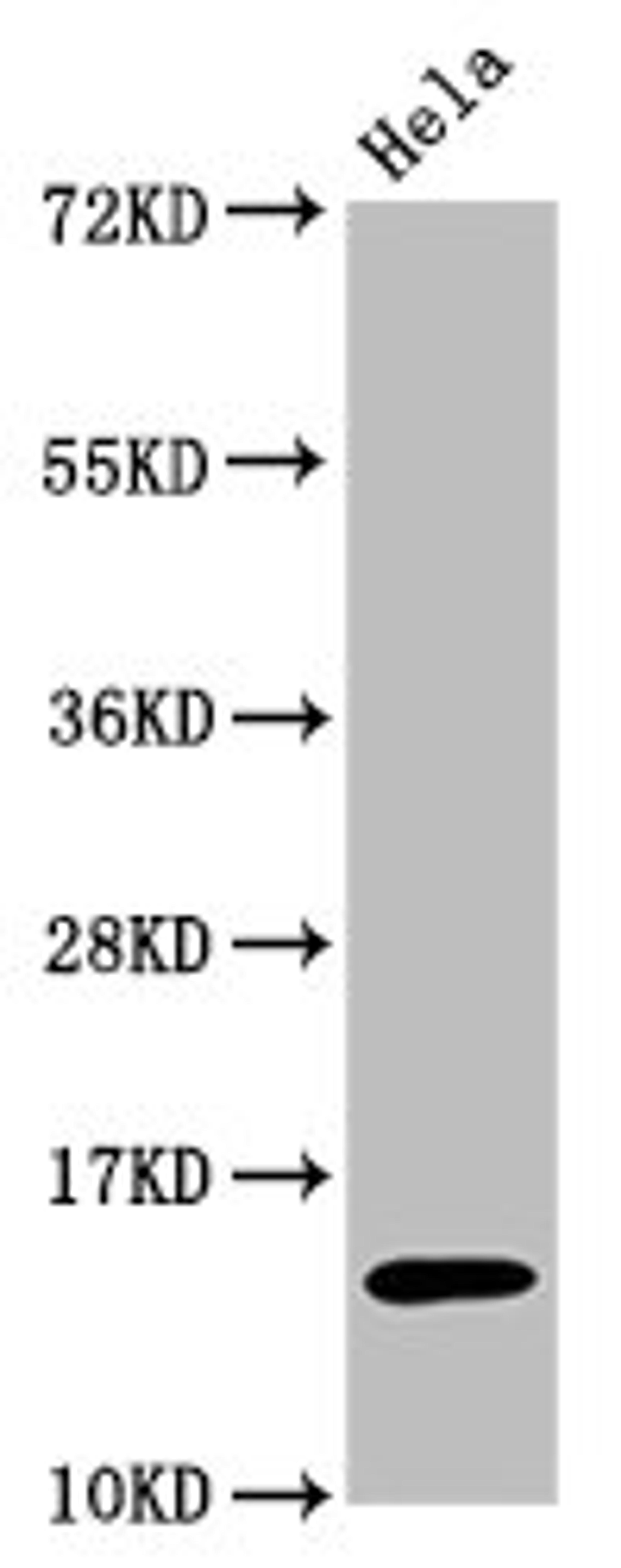 Western Blot. Positive WB detected in:Hela whole cell lysate treated by 15mM sodium butyrate for 30min. All lanes:Acetyl-Histone H3.1(K56)antibody at 0.7μg/ml. Secondary. Goat polyclonal to rabbit IgG at 1/50000 dilution. Predicted band size: 15 KDa. Observed band size: 15 KDa. 