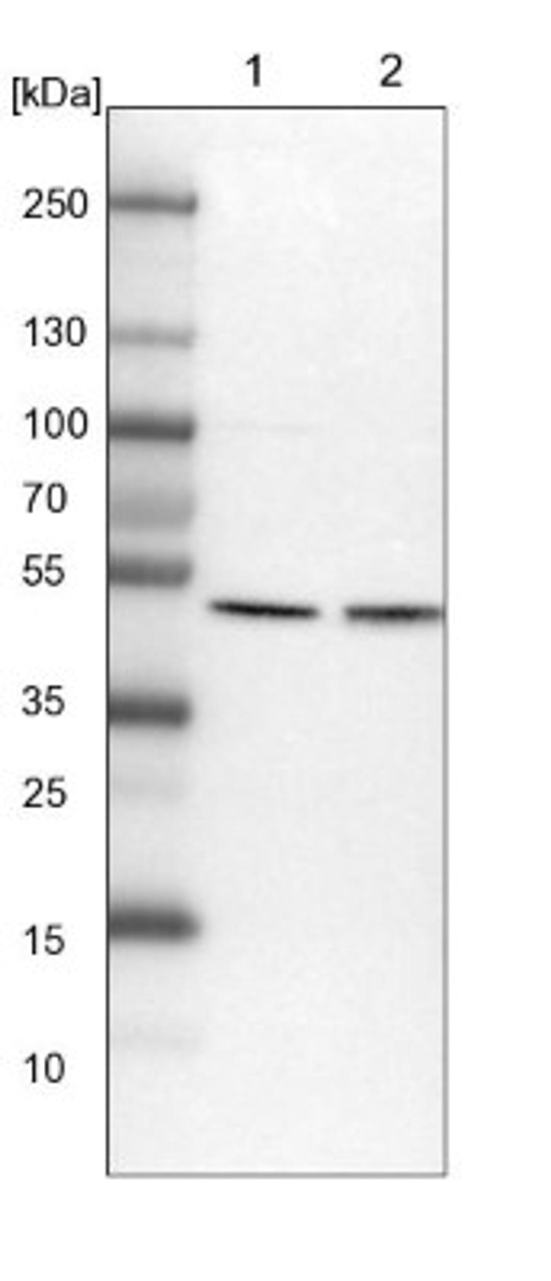 Western Blot: ATG4A Antibody [NBP1-89044] - Lane 1: NIH-3T3 cell lysate (Mouse embryonic fibroblast cells)<br/>Lane 2: NBT-II cell lysate (Rat Wistar bladder tumour cells)