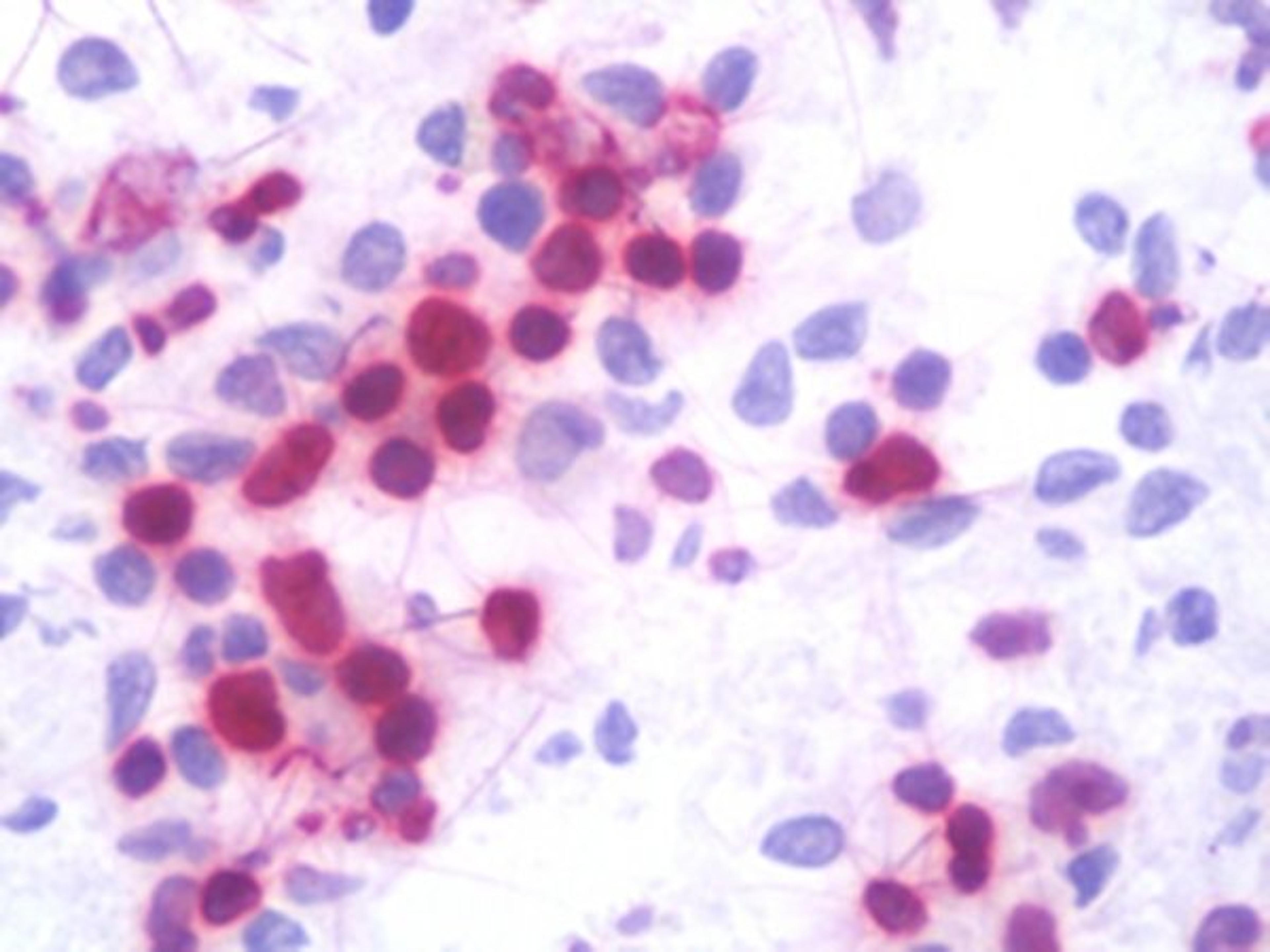 Immunohistochemical analysis of formalin-fixed and paraffin-embedded on frozen human spleen. tissue using LMNB1 antibody