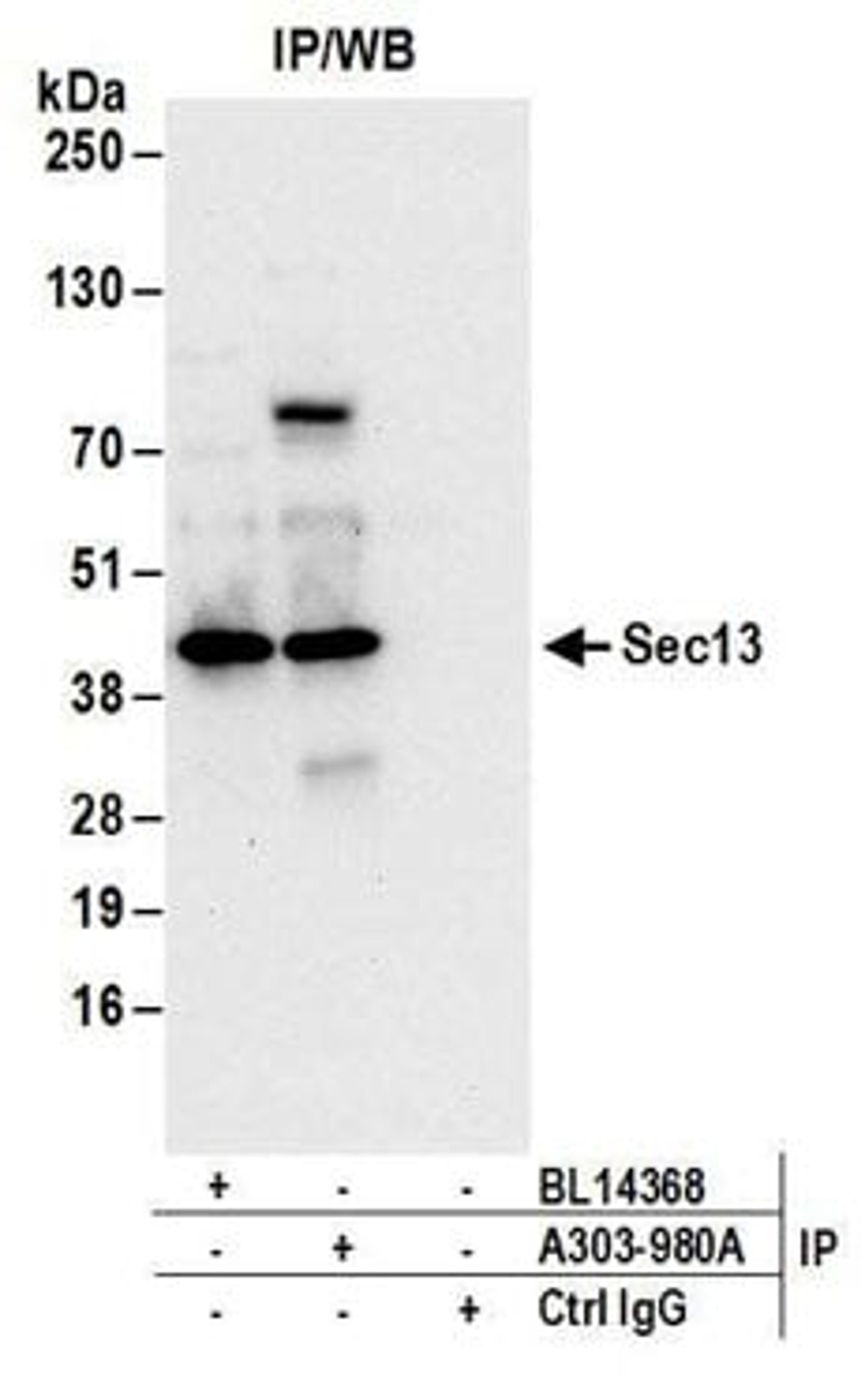 Detection of human Sec13 by western blot of immunoprecipitates.