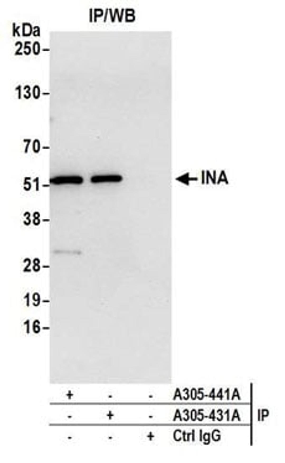 Detection of human INA by western blot of immunoprecipitates.