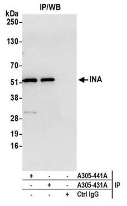 Detection of human INA by western blot of immunoprecipitates.