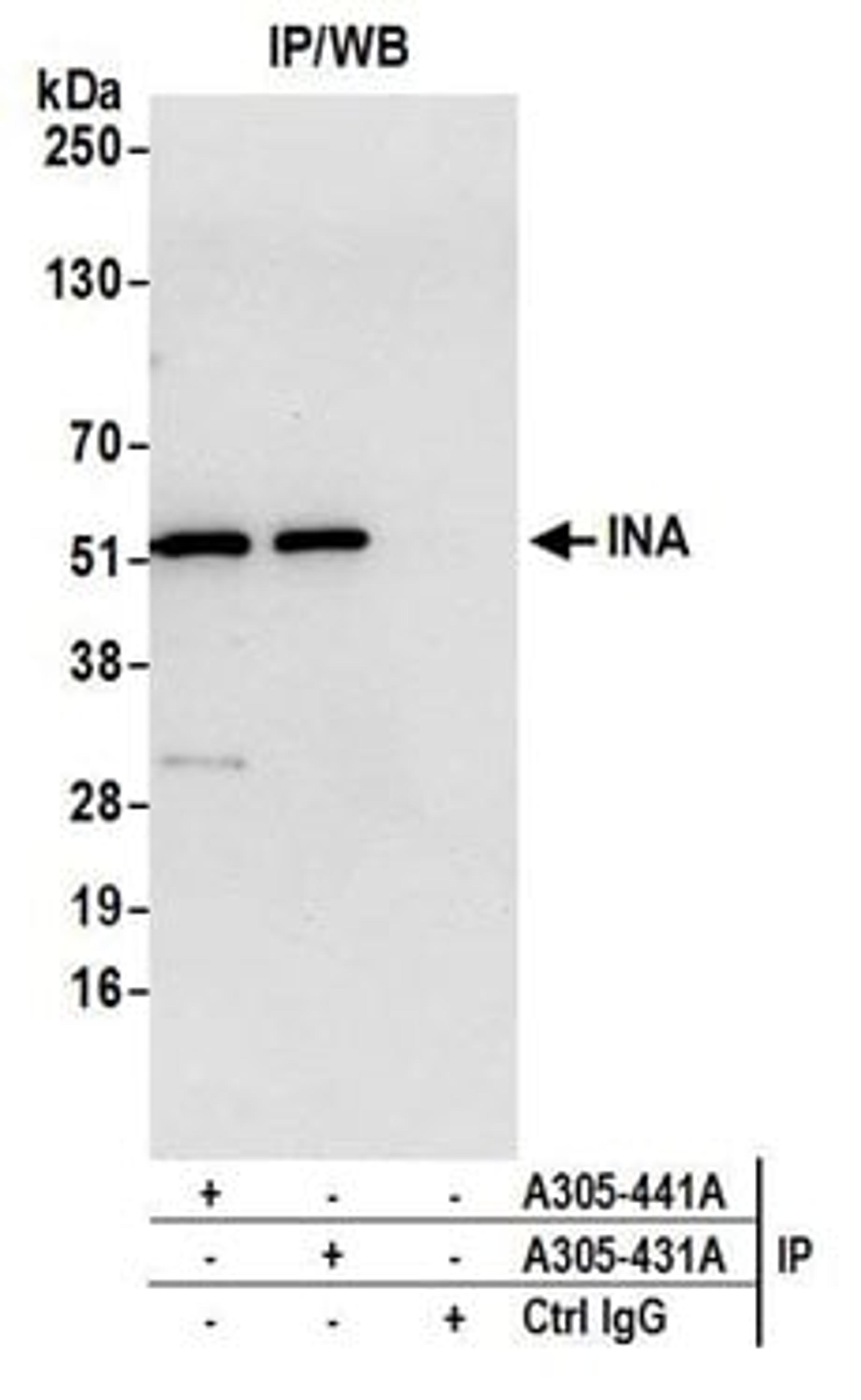 Detection of human INA by western blot of immunoprecipitates.