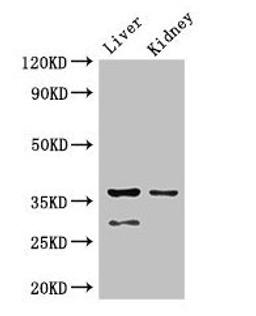 Western Blot. Positive WB detected in: Mouse liver tissue, Mouse kidney tissue. All lanes: PPP2CA antibody at 2.5ug/ml. Secondary. Goat polyclonal to rabbit IgG at 1/50000 dilution. Predicted band size: 36, 30 kDa. Observed band size: 36, 30 kDa.