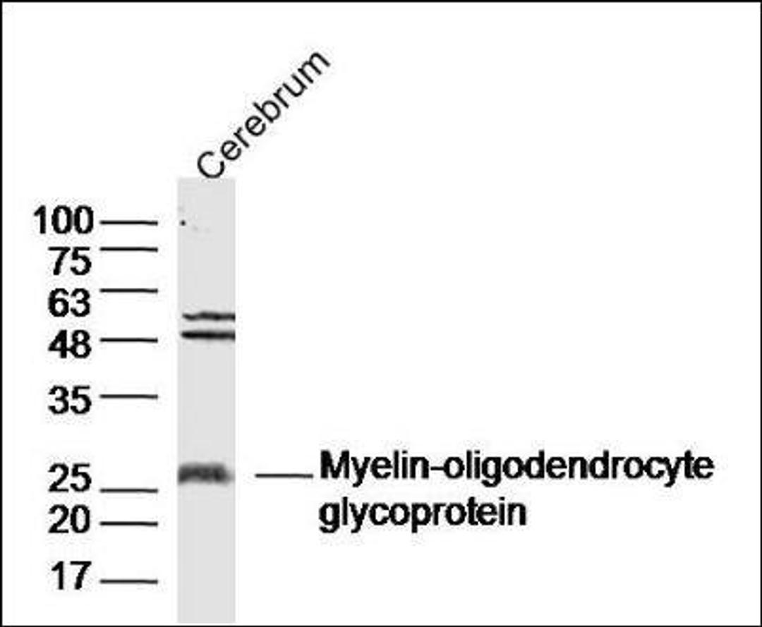 Western blot analysis of Rat Cerebrum lysates using MOG antibody.