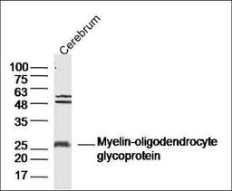 Western blot analysis of Rat Cerebrum lysates using MOG antibody.